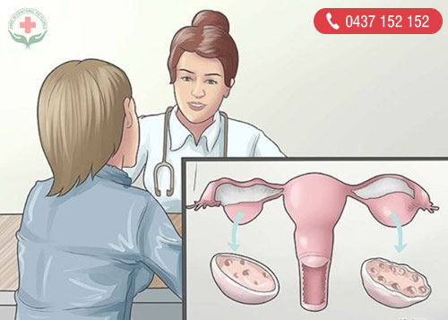 Dấu hiệu nào cho thấy bạn đang bị u nang buồng trứng?
