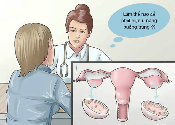 Các cách phát hiện bệnh u nang buồng trứng