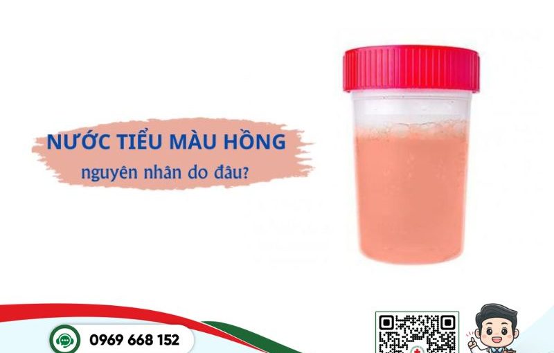 Nước tiểu có màu hồng: Nên lo lắng hay chủ quan?