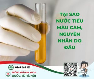 Tại sao nước tiểu màu cam, nguyên nhân do đâu